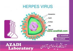 ویروس HSV