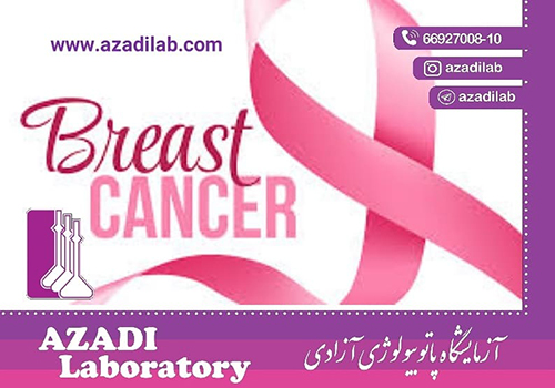 علت درخواست تست CA153 چیست و چه کاربردهای بالینی دارد.