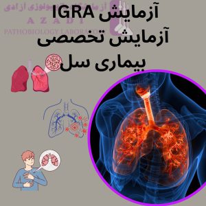 آزمایش IGRA چیست